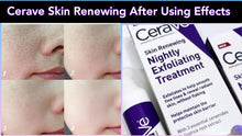Load image into Gallery viewer, CeraVe Skin Renewing Nightly Exfoliating Treatment - 50ml