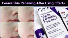 Load image into Gallery viewer, CeraVe Skin Renewing Nightly Exfoliating Treatment - 50ml
